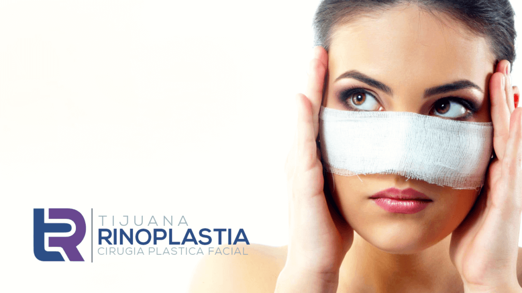 ¿Qué es la rinoplastia?